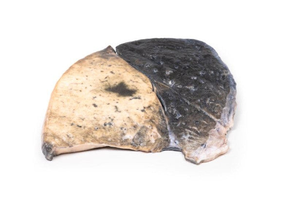 Lobar Pneumonia 3D Printed Anatomy Model