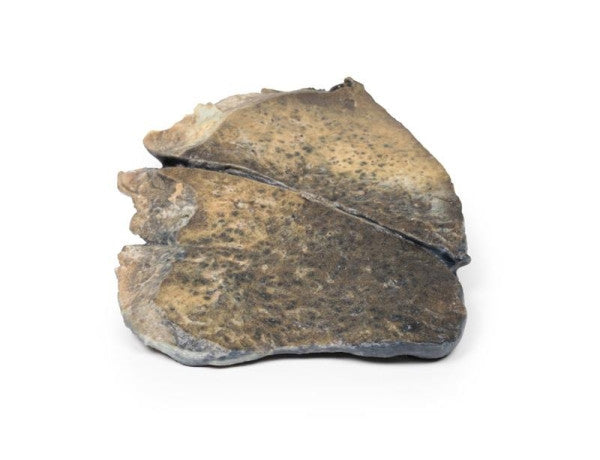 Bronchi 3D Printed Anatomy Model