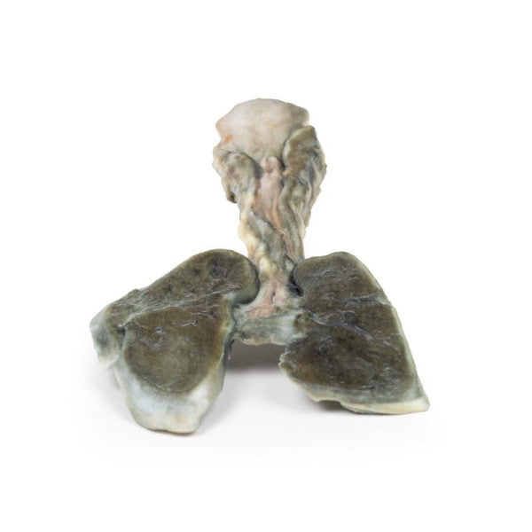 Oesophageal Pathology 3D Printed Anatomy Model