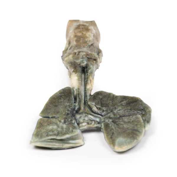 Oesophageal Pathology 3D Printed Anatomy Model