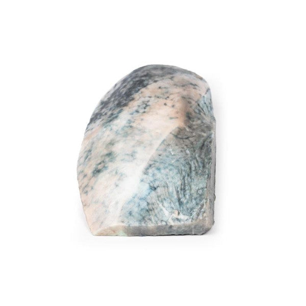 Lobar Pneumonia 3D Printed Anatomy Model