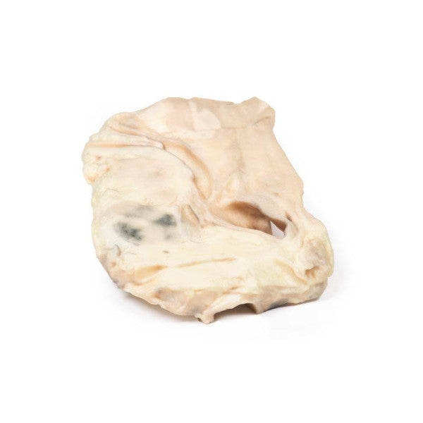 Lymphoma 3D Printed Anatomy Model