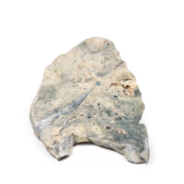 Lung 3D Printed Anatomy Model