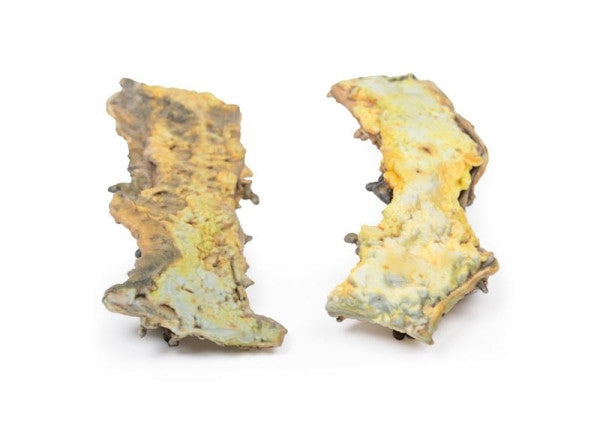 Bowel Pathology 3D Printed Anatomy Model