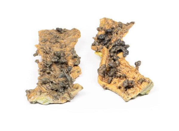 Bowel Pathology 3D Printed Anatomy Model