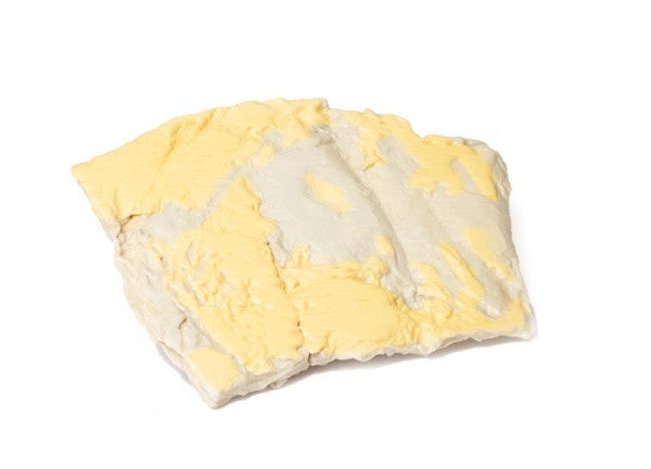 Adenoma 3D Printed Anatomy Model