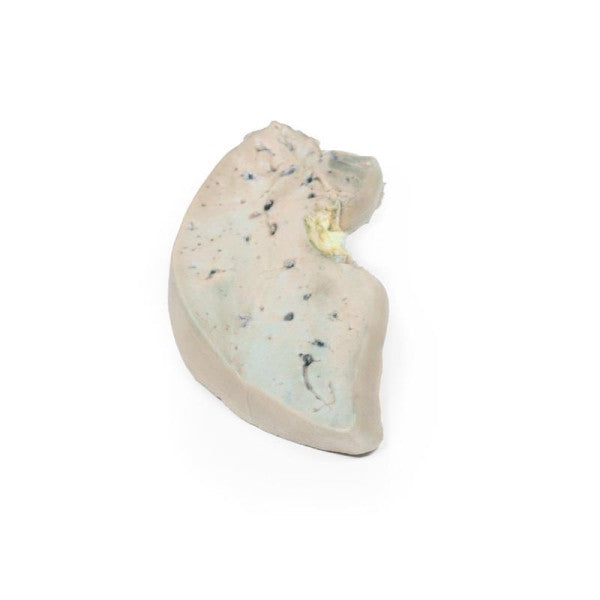 Liver 3D Printed Anatomy Model