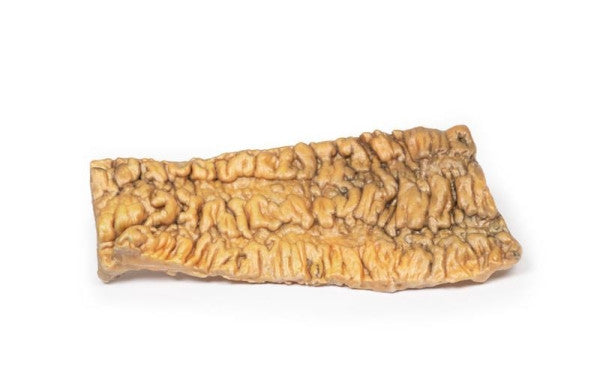 Bowel Pathology 3D Printed Anatomy Model