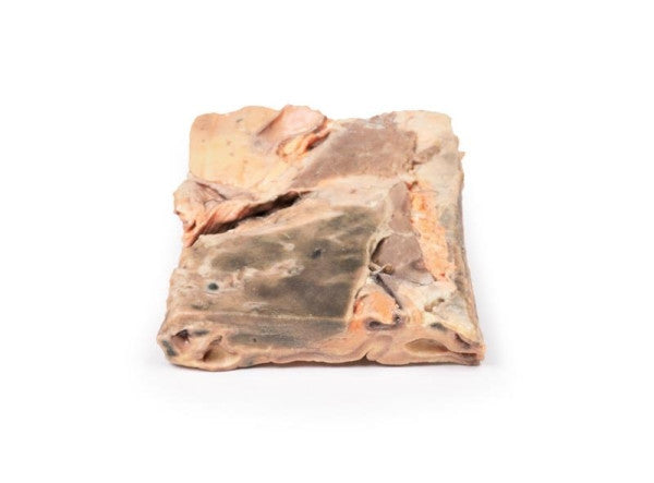 Stomach 3D Printed Anatomy Model