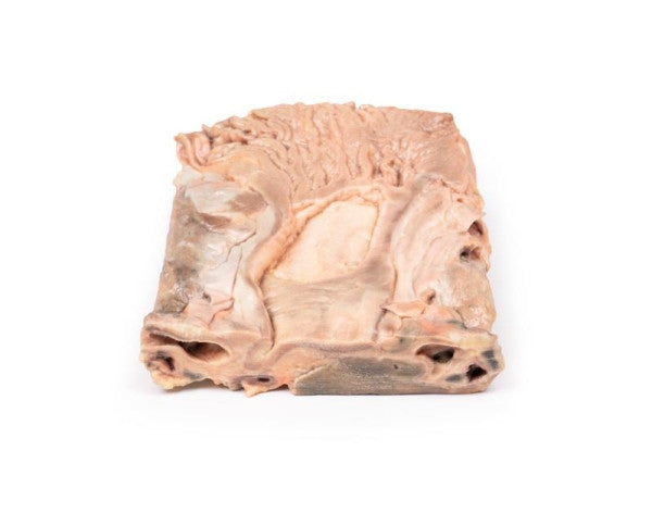 Stomach 3D Printed Anatomy Model