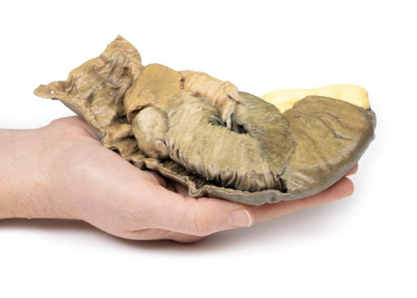 Bowel Pathology 3D Printed Anatomy Model