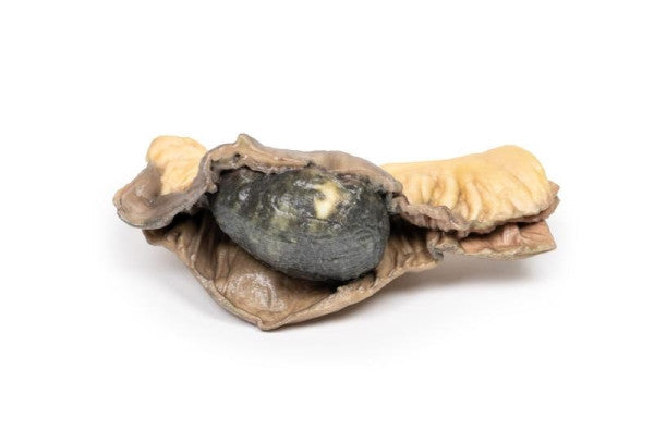 Cholelithiasis (Gallstones) 3D Printed Anatomy Model