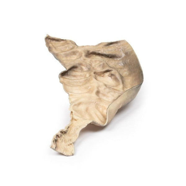 Bowel Pathology 3D Printed Anatomy Model