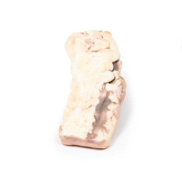 Adenoma 3D Printed Anatomy Model
