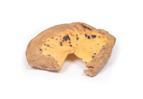 Melanoma 3D Printed Anatomy Model