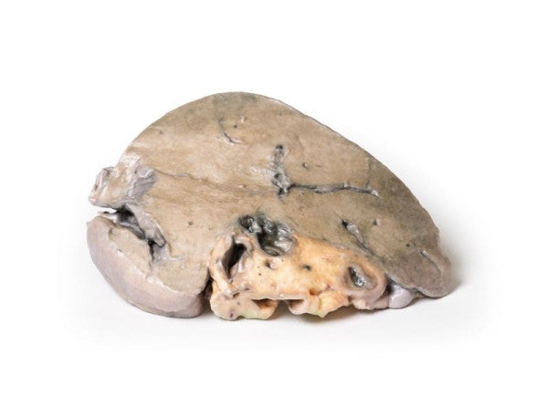 Liver 3D Printed Anatomy Model