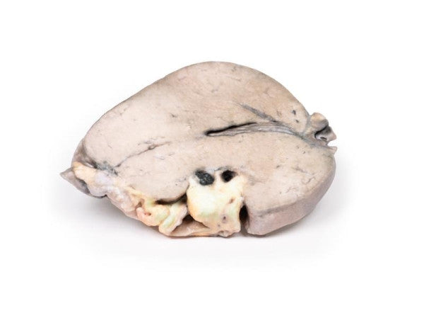 Liver 3D Printed Anatomy Model