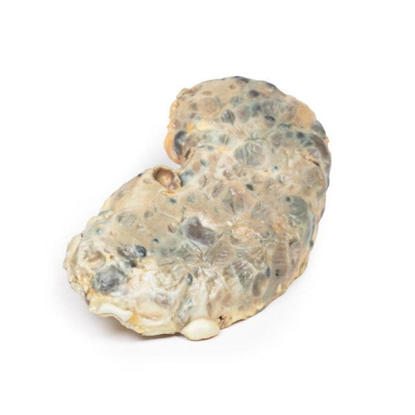 Renal Pathology 3D Printed Anatomy Model