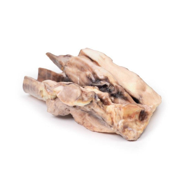 Lymphoma 3D Printed Anatomy Model