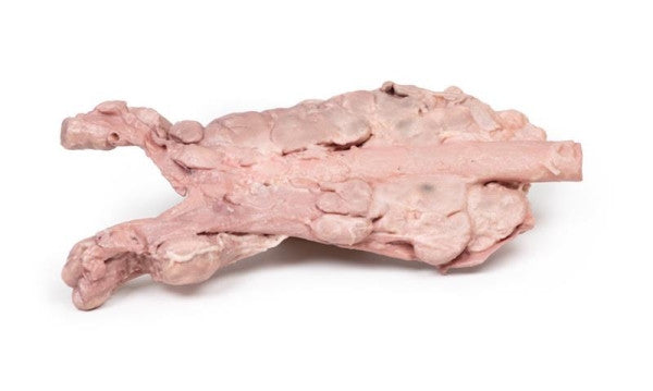 Aorta & Para-aortic Lymph Nodes 3D Printed Anatomy Model