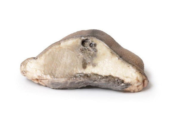 Carcinoma 3D Printed Anatomy Model