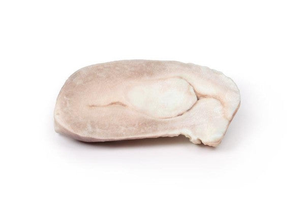 Uterus Pathology 3D Printed Anatomy Model