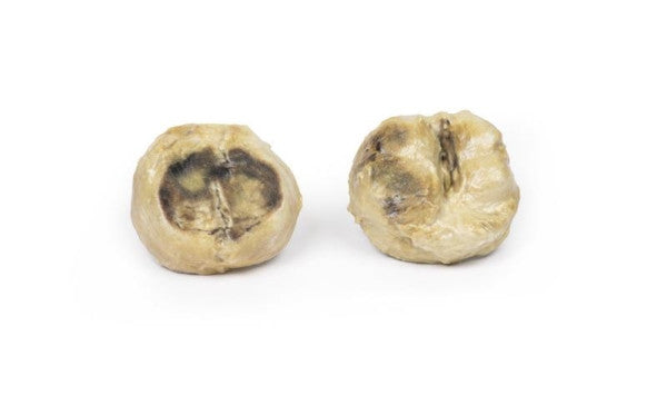 Nodular Hyperplasia of the Prostate 3D Printed Anatomy Model