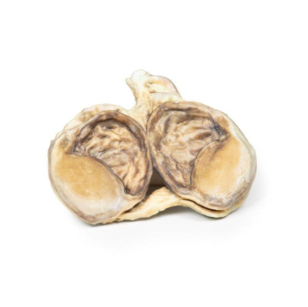 Hydrocoele 3D Printed Anatomy Model