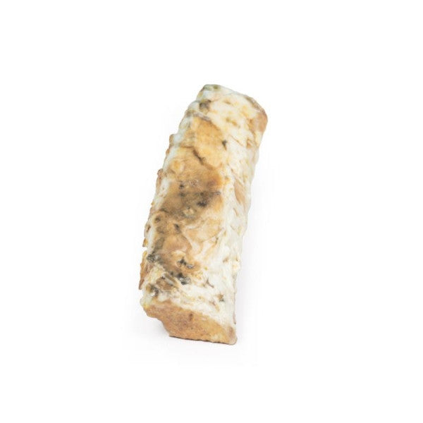 Tuberculosis 3D Printed Anatomy Model