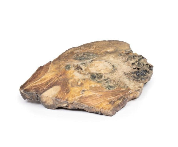 Chondrosarcoma 3D Printed Anatomy Model