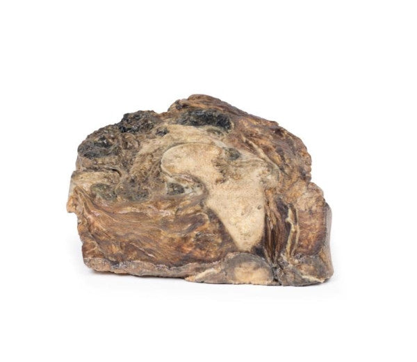 Chondrosarcoma of Femur and Ilium Model