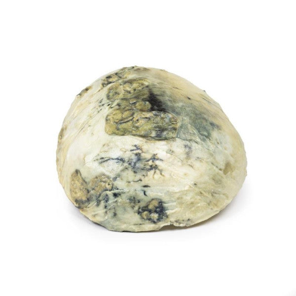 Tertiary Syphilis 3D Printed Anatomy Model