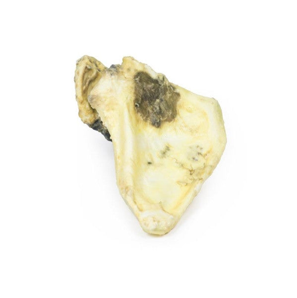 Chondrosarcoma 3D Printed Anatomy Model