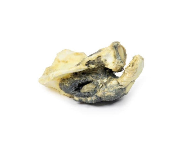 Superior aspect of the Chondrosarcoma of Scapula Model