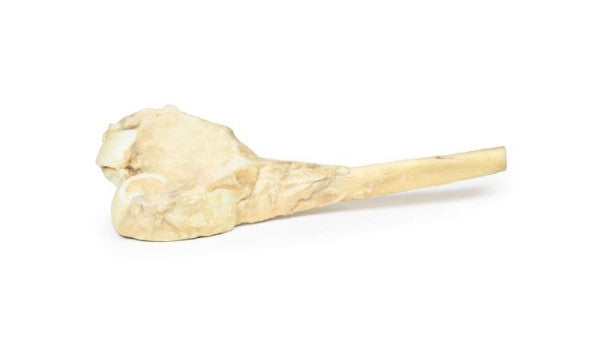 Osteosarcoma of Femur 3D Printed Anatomy Model