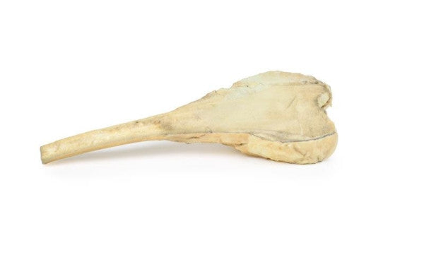 Osteosarcoma of Femur 3D Printed Anatomy Model