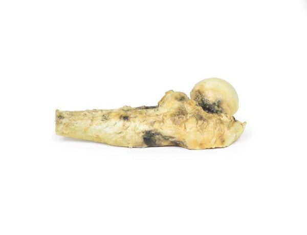 Osteosarcoma of Femur 3D Printed Anatomy Model