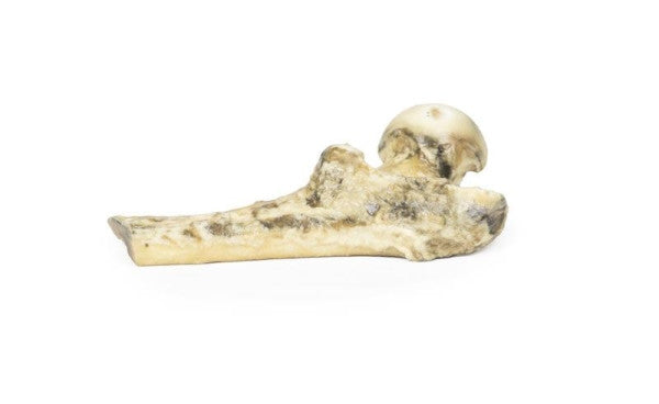 Melanoma 3D Printed Anatomy Model