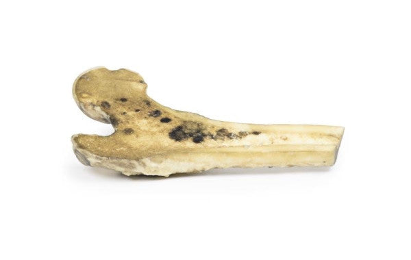 Melanoma 3D Printed Anatomy Model