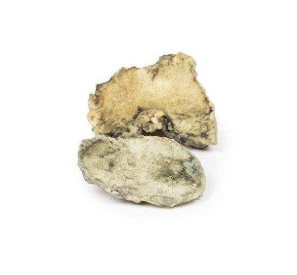 Suppurative Arthritis of the Knee 3D Printed Anatomy Model