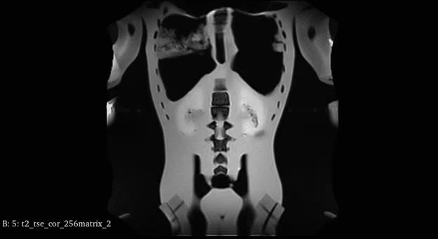 Adult Full Body Phantom with Muscles for X-Ray CT, MRI