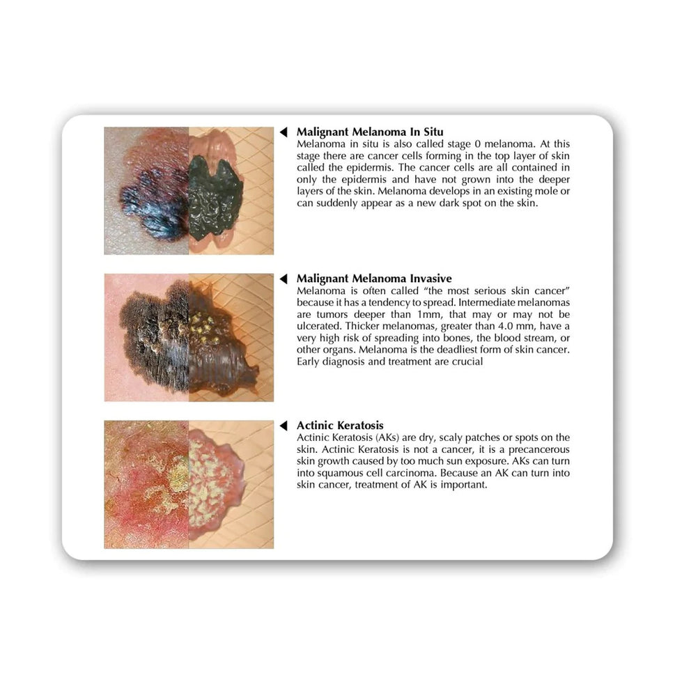 Skin Cancer Model (8 Skin Conditions)