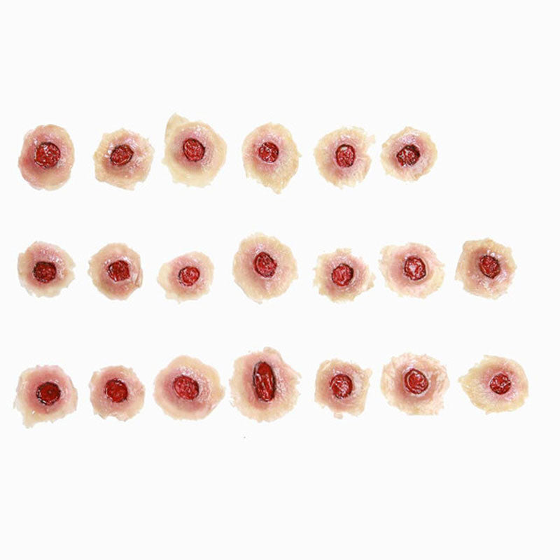 Moulage Set of Gunshot Entry Wounds (20 Pieces)