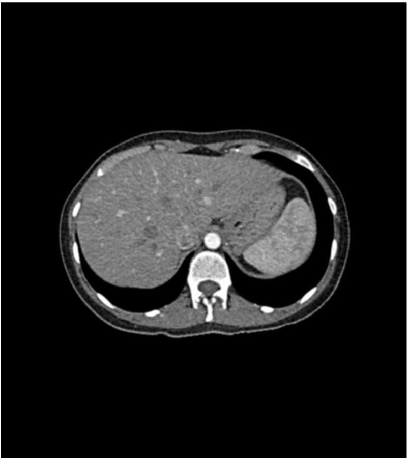 Anatomy Phantom Models for CT, X-Ray, and Radiation Therapy