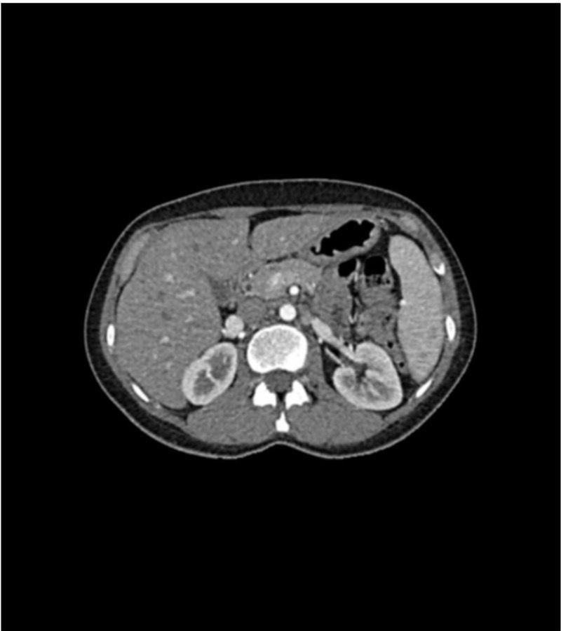 Anatomy Phantom Models for CT, X-Ray, and Radiation Therapy