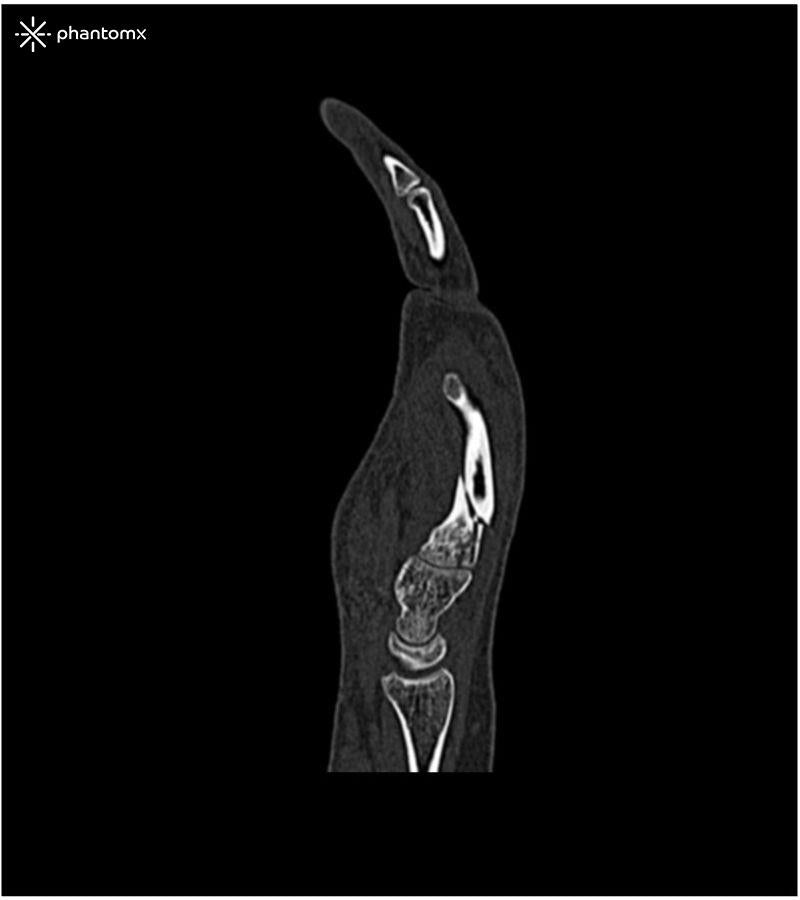 Anatomy Phantom Models for CT, X-Ray, and Radiation Therapy