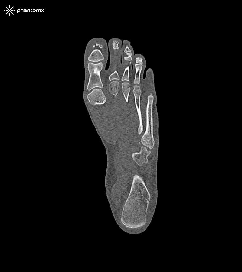 Anatomy Phantom Models for CT, X-Ray, and Radiation Therapy