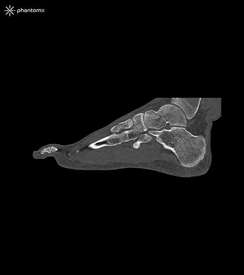 Anatomy Phantom Models for CT, X-Ray, and Radiation Therapy