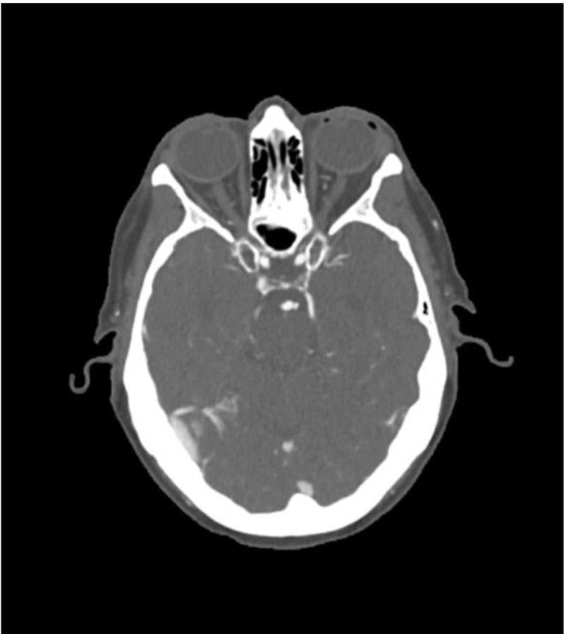 Anatomy Phantom Models for CT, X-Ray, and Radiation Therapy
