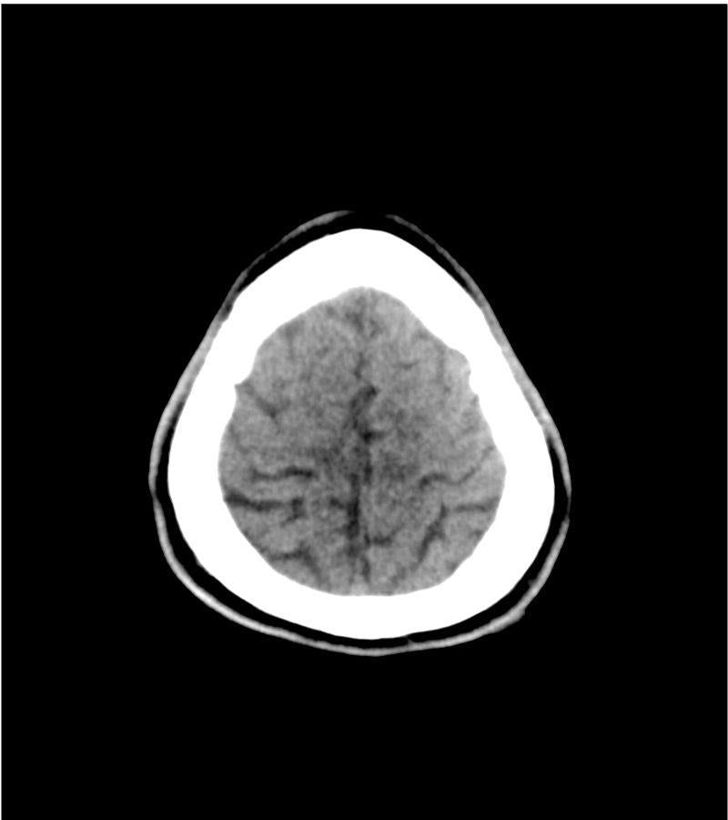 Anatomy Phantom Models for CT, X-Ray, and Radiation Therapy